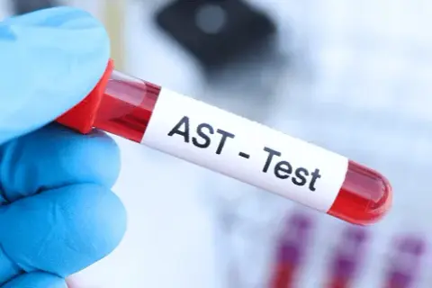 AST (Aminotransferaza): Rozszyfruj wyniki, normy i przygotowanie