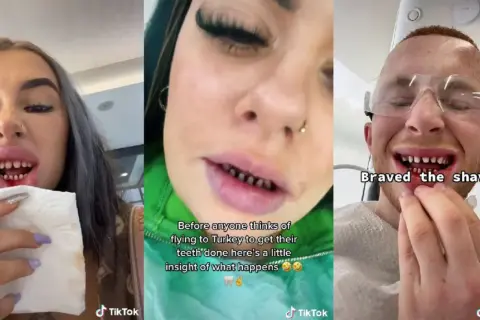 Trzy osoby pokazują swoje zęby po zabiegu stomatologicznym w Turcji. Jedna z nich trzyma chusteczkę, druga ma napis "Braved the shave".