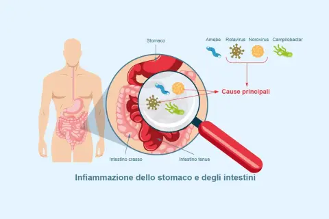 Illustrazione dell'apparato digerente con ingrandimento che mostra i microrganismi causa di gastroenterite sintomi.