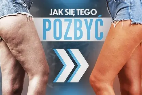 Jak skutecznie pozbyć się cellulitu? Kompletny poradnik ekspertki.