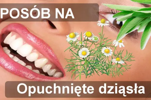 Opuchnięte dziąsła: Szybka ulga i skuteczne sposoby (domowe i apteczne)