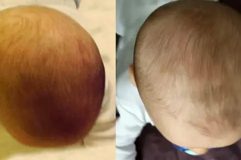Head Care: Po jakim czasie poduszka skoryguje spłaszczoną główkę?