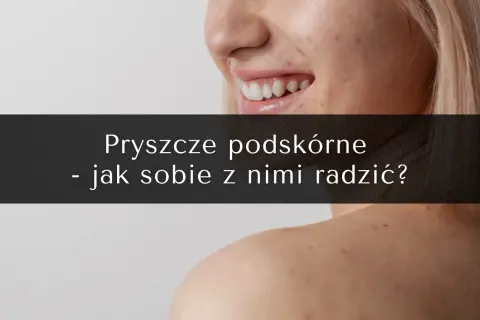 Bolesne pryszcze podskórne: Jak się ich pozbyć bez blizn?