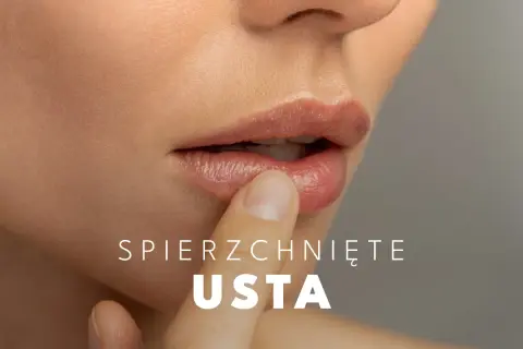 Zbliżenie na usta, które dotyka palec. Tekst: "Spierzchnięte usta". Poznaj suche usta przyczyny.