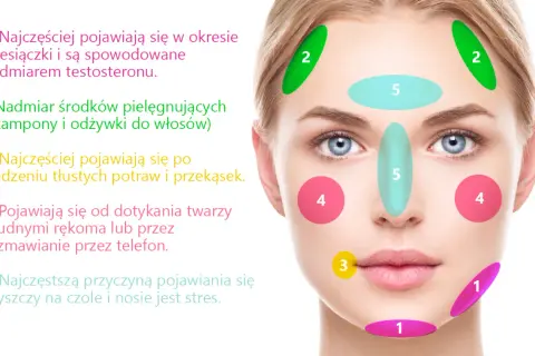 Pryszcze na czole: Poznaj przyczyny i pozbądź się ich raz na zawsze!