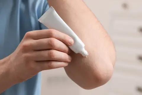 Mężczyzna aplikuje masc z wit a na łokieć.