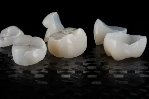 Kilka białych, ceramicznych koron dentystycznych leży na czarnym, błyszczącym tle.
