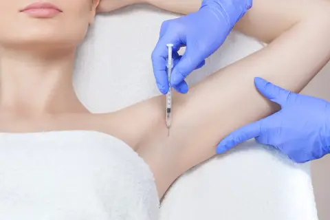 Zabieg botox pod pachy dla komfortu i pewności siebie.