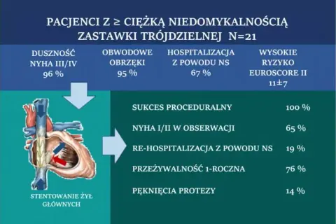 Niedomykalność zastawki objawy: jak je rozpoznać i co robić?