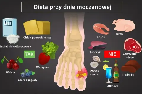 Dieta przy dnie moczanowej: TAK - nabiał, wiśnie, jagody, warzywa. NIE - czerwone mięso, podroby, alkohol. Milurit 100 może pomóc.