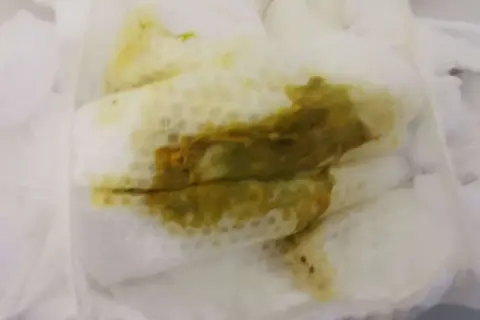 Jak wyglądają kupki przy ząbkowaniu? Co powinno niepokoić rodziców?