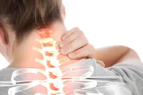 Douleur au cou due à une inversion de la courbure cervicale. Une main masse la nuque douloureuse, où la colonne vertébrale est mise en évidence.