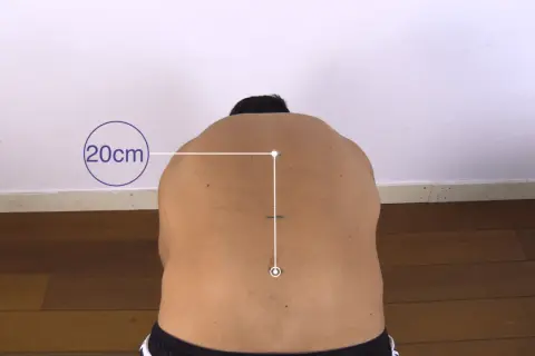 Messung der Flexibilität des Rückens mit dem Schober-Test. Markierungen zeigen 20 cm Abstand.