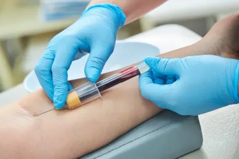 Pobieranie krwi do badań, które mogą wykazać złe wyniki prób wątrobowych.