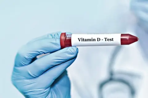 Blå handskbeklädd hand håller provrör märkt "Vitamin D - Test". Kan hjälpa till att identifiera d-vitamin brist symtom.