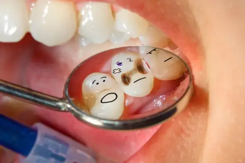 Zęby z namalowanymi buźkami w odbiciu lusterka dentystycznego. Jeden ząb ma próchnicę i wygląda na chorego. Czy zęby się regenerują?