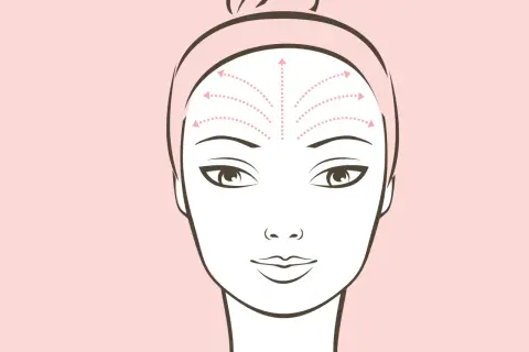 Illustrazione di un viso con frecce che indicano movimenti verso l'alto sulla fronte, suggerendo l'effetto lifting significato.