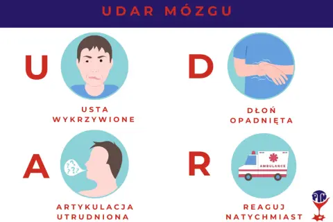 Udar mózgu skutki: wykrzywione usta, opadnięta dłoń, trudna artykulacja. Reaguj natychmiast!