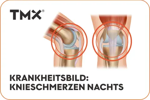 Anatomische Darstellung von Kniegelenken, die **Knieschmerzen nachts** thematisieren.