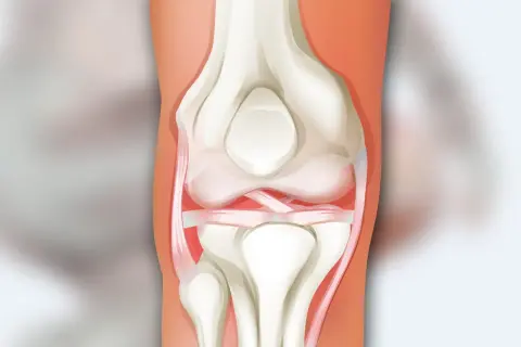 Anatomia stawu kolanowego: kości udowa i piszczelowa, rzepka oraz więzadła.
