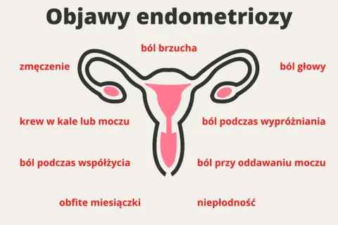 Objawy endometriozy: ból brzucha, zmęczenie, krew w kale/moczu, ból głowy, ból podczas wypróżniania, ból przy oddawaniu moczu, ból podczas współżycia, obfite miesiączki, niepłodność.