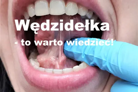 Kiedy zacząć ćwiczyć po podcięciu wędzidełka, aby uniknąć problemów?