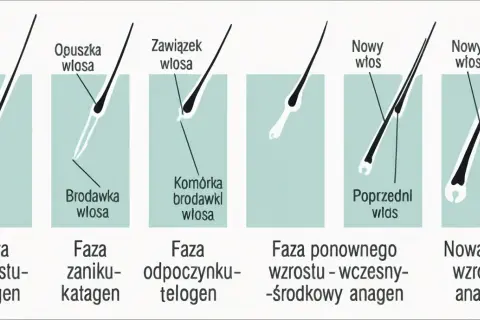 Cykl życia włosa: anagen (wzrost), katagen (zanik), telogen (odpoczynek), a potem nowy włos wyrasta.