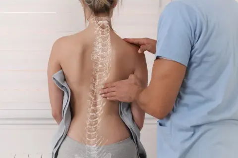 Fizjoterapeuta bada kręgosłup pacjentki, na którym widoczny jest zarys kifozy piersiowej.