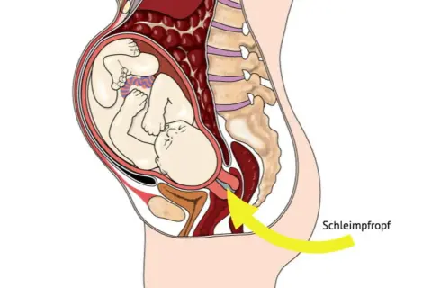 Der Schleimpfropf löst sich – ein Zeichen, dass die Geburt bald los geht. Das Baby liegt bereit im Mutterleib.