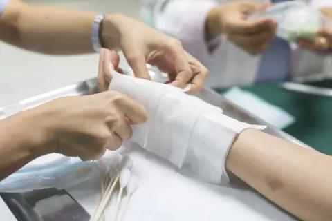 Opatrywanie ręki po oparzeniu primerem kwasowym. Zespół medyczny zakłada opatrunek.