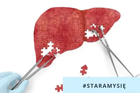 Wątroba z puzzli, którą składają szczypce. Badanie na obecność hbs antygen to klucz do zdrowia. #STARAMYSIĘ