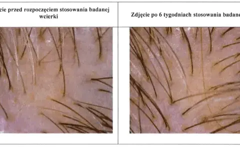 Co daje masaż głowy? Odkryj sekrety zdrowych włosów i relaksu