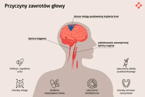 Ilustracja pokazuje przyczyny zawrotów głowy: problemy z krążeniem mózgu, infekcje ucha, choroby mózgu, leki, zaburzenia metaboliczne, sercowo-naczyniowe i układu przedsionkowego.