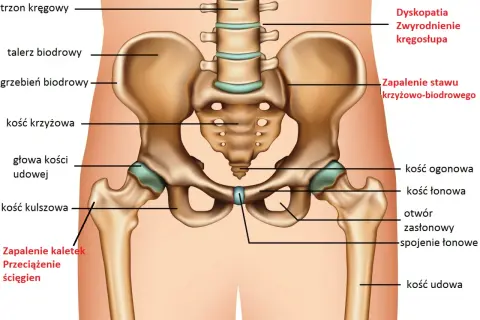 Anatomia miednicy i stawów biodrowych z zaznaczonymi strukturami kostnymi i schorzeniami.