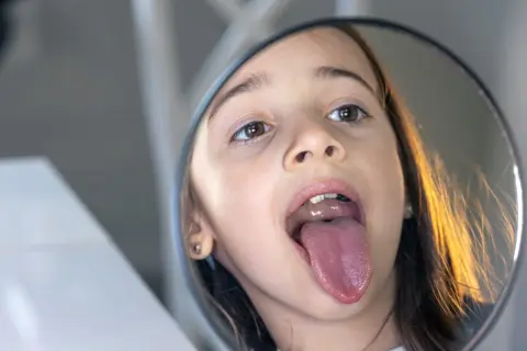 Dziewczynka w lustrze pokazuje swój język, który wygląda jak mały, różowy **tongue web**.