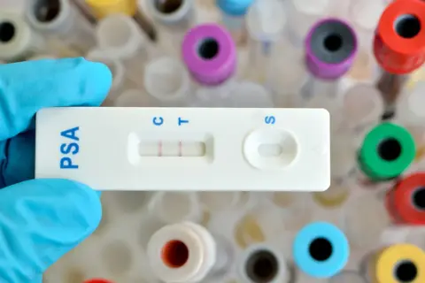 Rękawiczka trzyma test PSA z dwoma paskami, wskazującymi wynik. W tle widać probówki.