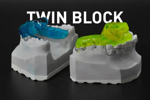 Modelli dentali con apparecchi **twin block ortodonzia** blu e gialli, pronti per correggere la malocclusione.