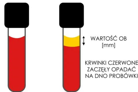 Skrzep w próbce krwi: Błąd czy choroba? Zrozum swój wynik
