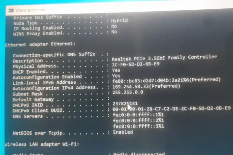 Komunikat o błędzie: karta sieciowa ethernet nie ma poprawnej konfiguracji protokołu IP. Widoczny jest adres IPv4 169.254.58.33.