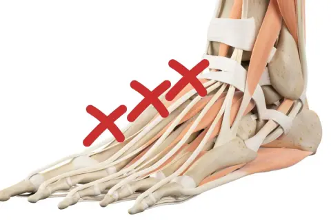 Anatomia del piede con tre croci rosse sui tendini del dorso. Possibili rimedi per il dolore sul dorso del piede.