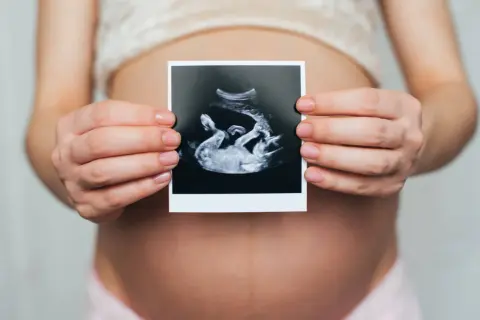 Dłoń kobiety trzyma zdjęcie USG z widocznym dzieckiem i łożyskiem na przedniej ścianie macicy.