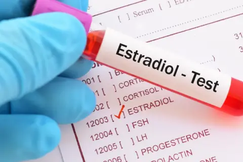 Rękawiczka trzyma probówkę z krwią do testu estradiolu. Wyniki badań wskazują na potrzebę zbicia estrogenu na cyklu.