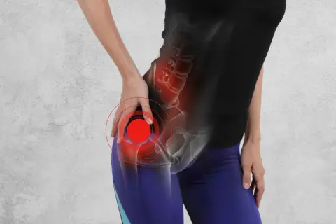 Ból biodra z powodu koksartrozy, zaznaczony czerwonymi kręgami.