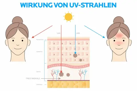 Illustration zeigt, wie UVA und UVB-Strahlen die Haut schädigen. Sonnencreme schützt vor diesen Strahlen.