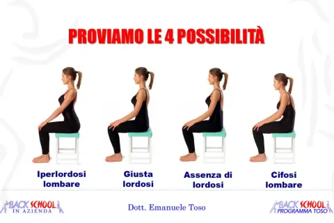 Quattro posture a confronto: iperlordosi lombare, lordosi corretta, assenza di lordosi e cifosi lombare. Utile per esercizi posturali.