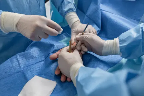 Chirurg ręki: Jak wybrać najlepszą klinikę i specjalistę?