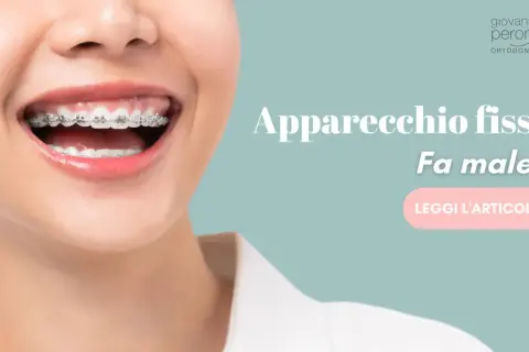 Sorriso con apparecchio fisso. Fa male togliere l'apparecchio fisso? Scopri di più leggendo l'articolo.