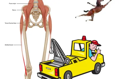 Anatomia della bandelletta ileotibiale e muscoli correlati. Un cavallino in posa e un carro attrezzi sorridente suggeriscono esercizi per la bandelletta ileotibiale.