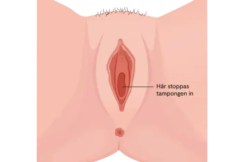 Illustration av en kvinnas underliv. En pil pekar in i vaginan med texten "Här stoppas tampongen in". Kan vara relevant vid diskussion om svamp i underlivet gravid.