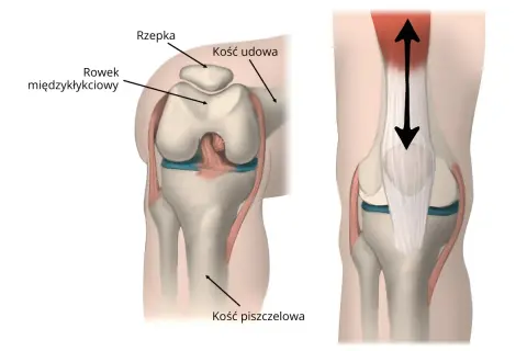 Ilustracja anatomiczna stawu kolanowego z zaznaczoną rzepką, kością udową i piszczelową.